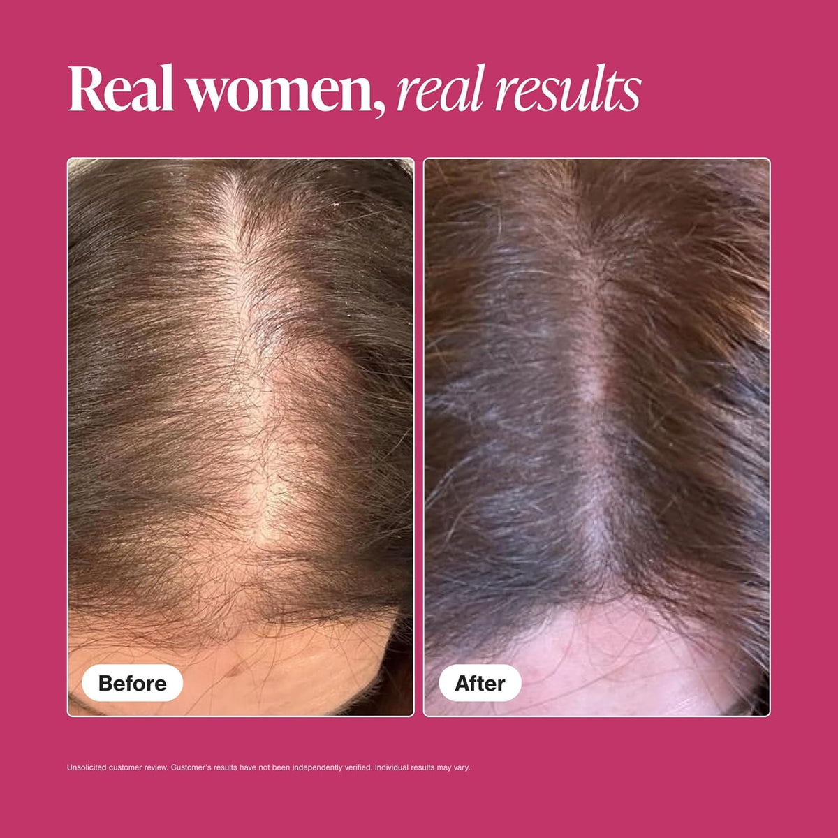 Viviscal Hair Growth Supplements For Women, 60 Tablets