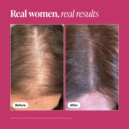 Viviscal Hair Growth Supplements For Women, 60 Tablets